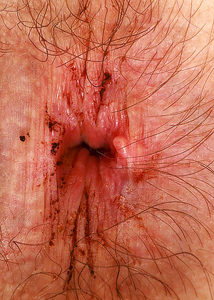 free sex pornphoto 22 Ronnie Kim wchat-hairy-www-xxxvipde atkhairy