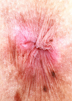 free sex pornphoto 18 Renee Rose balamsex-skinny-deluca atkpetites
